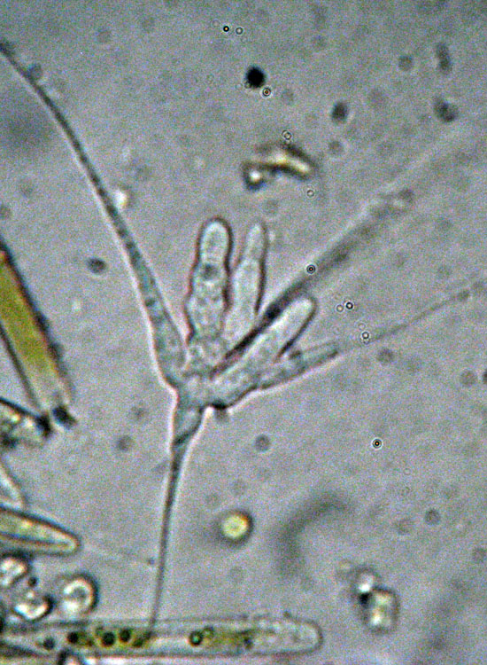 Fungo acquatico: direi Tetracladium setigerum